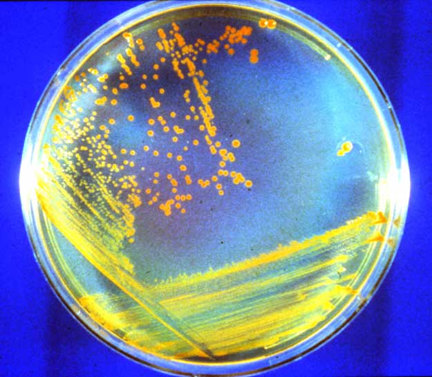 Bacteria indestructible